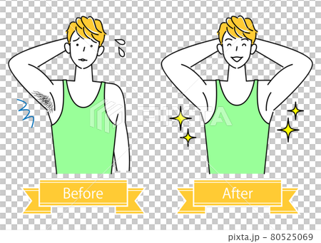 ムダ毛処理 わき毛を脱毛する可愛い男性のビフォーアフター イラスト シンプル ベクター ムダ毛処理 わき毛を脱毛する可愛い男性のビフォーアフター イラスト シンプル ベクター 80525069