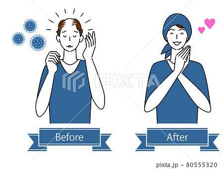 ヘアケア 薄毛対策で医療用のお洒落なケア帽子をかぶる可愛い男性のビフォーアフター イラスト シンプル 80555320