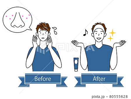 スキンケア 顔のお肌トラブルのビフォーアフター 可愛い男性のイラスト シンプル ベクター 80555628
