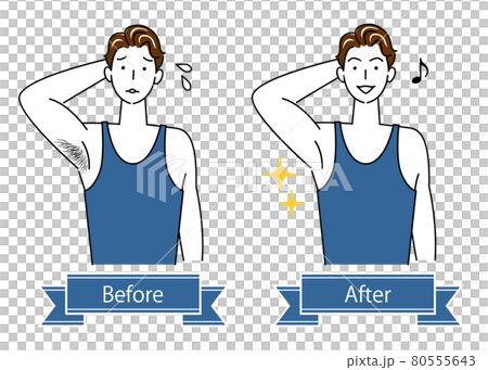 Unwanted hair treatment Before and after illustration of a cute man who removes armpit hair Simple vector 80555643