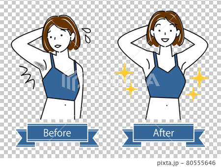 Unwanted hair treatment Before and after illustration of a cute woman who removes armpit hair Simple vector 80555646