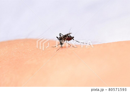 血でお腹が膨れる蚊 血でお腹が膨れる蚊 80571593