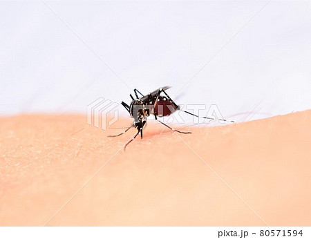 吸血するヒトスジシマカ 蚊 吸血するヒトスジシマカ 蚊 80571594