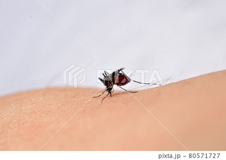 腹部が血液で膨らんだ蚊 ヒトスジシマカ 腹部が血液で膨らんだ蚊 ヒトスジシマカ 80571727
