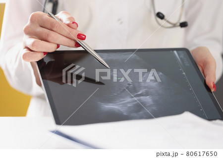 Gynecologist shows ultrasound of baby fetus on tablet 80617650