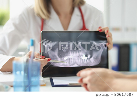 Professional dentist shows patient x-rays of jaws and teeth using digital tablet device 80617687