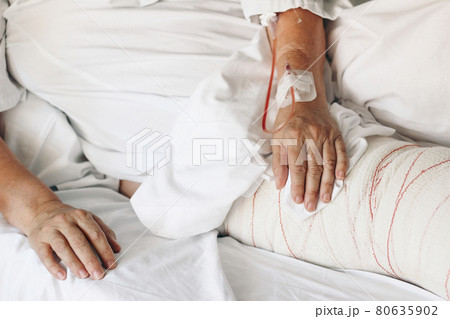 Injured old woman lying in bed with white blanket in hospital. Closeup of hands with vein cannula and bandaged leg. Emergency surgical treatment. Ilness, healing and recovery concept. Elderly care. Injured old woman lying in bed with white blanket in hospital. Closeup of hands with vein cannula and bandaged leg. Emergency surgical treatment. Ilness, healing and recovery concept. Elderly care. 80635902