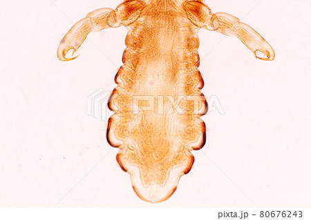 The head louse (Pediculus humanus capitis) is a parasite Live on the body, person or animal and live by sucking blood into food. The head louse (Pediculus humanus capitis) is a parasite Live on the body, person or animal and live by sucking blood into food. 80676243
