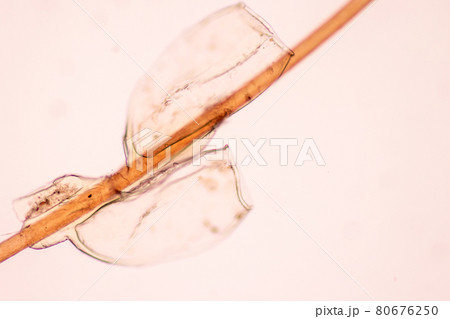 The head louse (Pediculus humanus capitis) is a parasite Live on the body, person or animal and live by sucking blood into food. 80676250