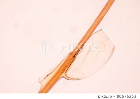 The head louse (Pediculus humanus capitis) is a parasite Live on the body, person or animal and live by sucking blood into food. The head louse (Pediculus humanus capitis) is a parasite Live on the body, person or animal and live by sucking blood into food. 80676253