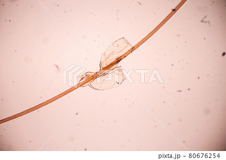 The head louse (Pediculus humanus capitis) is a parasite Live on the body, person or animal and live by sucking blood into food. The head louse (Pediculus humanus capitis) is a parasite Live on the body, person or animal and live by sucking blood into food. 80676254