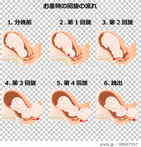 お産時の回旋の流れ 80687397