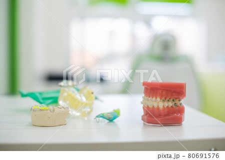 Orthodontic teeth models dental education model jaws with half ceramic and half metal bracket Teeth and Jaw Models. Orthodontic teeth models dental education model jaws with half ceramic and half metal bracket Teeth and Jaw Models. 80691576