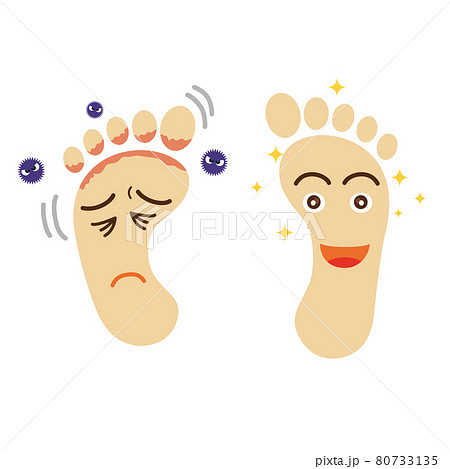 擬人化した水虫の足と健康な足のイラスト 足跡足の裏のイラスト ボディパーツフットヘルス健康イメージのイラスト素材