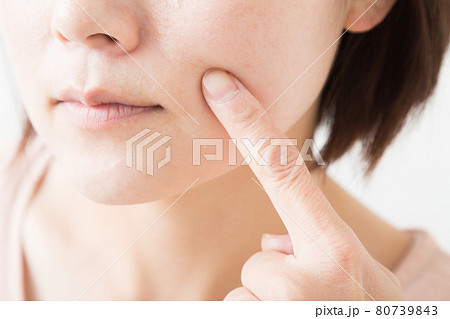 肌を気にする女性 80739843
