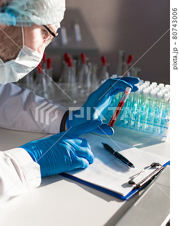 Close-up view - vertical photo of a doctor in a protective mask holds a test tube with a sample of infected blood. He looks closely at the sample before describing the virus in detail. Close-up view - vertical photo of a doctor in a protective mask holds a test tube with a sample of infected blood. He looks closely at the sample before describing the virus in detail. 80743006