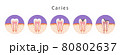 歯医者さんのイラスト歯科むし歯の絵セット 80802637