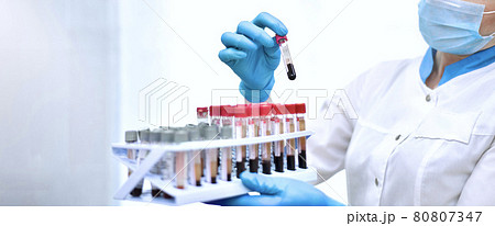 Hands of the laboratory assistant while working with blood tests in test tubes. Hands of the laboratory assistant while working with blood tests in test tubes. 80807347