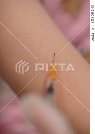 注射を打つ女の子 注射を打つ女の子 80809149