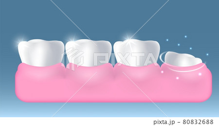 White healthy teeth and growing up new tooth, vector illustration. Dentistry, dental health, oral hygiene, stomatology. 80832688