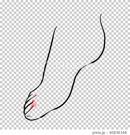 運動員的腳腳圖 80836166