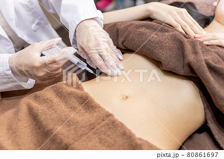 美容外科で施術を受ける女性(脂肪溶解注射・お腹) 美容外科で施術を受ける女性(脂肪溶解注射・お腹) 80861697