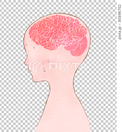Illustration of a person with heat stroke and a heated brain 80896702