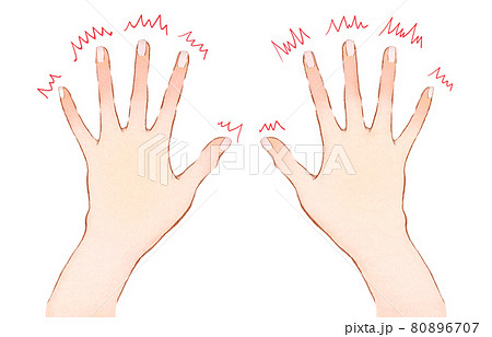 指先のしびれと手のイラスト 80896707
