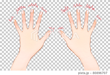Illustration of numbness of fingertips and hands 80896707