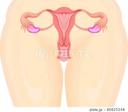 子宮　イラスト 80925248
