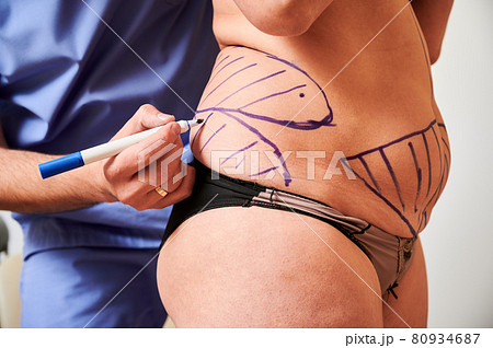 woman with body plastic surgery - Stock Illustration [49589447] - PIXTA