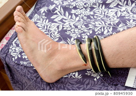 A poisonous snake wrapped around a man's leg. The concept of the danger of snake bite 80945930