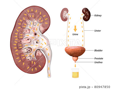 Scientific medical illustration of incision through the kidney, drainage of urine from the kidney and bladder anatomy 3d render, 2d graphic 80947850