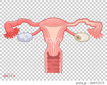 健康子宮、卵巢、輸卵管的插圖 80972573