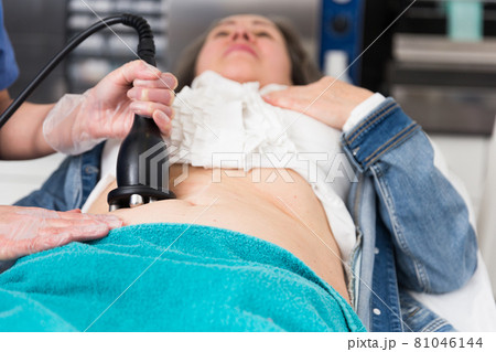 Procedure of RF lifting of abdomen skin of elderly female patient Procedure of RF lifting of abdomen skin of elderly female patient 81046144