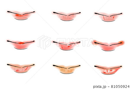 唇の荒れ、かさつき、ひび割れのイラスト 唇の荒れ、かさつき、ひび割れのイラスト 81050924
