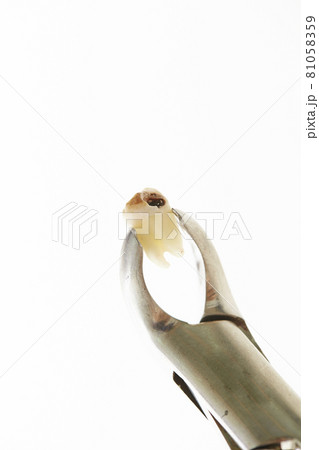 歯科器具　歯科イメージ 81058359