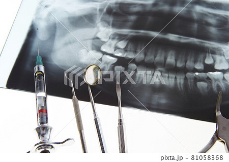 歯科器具　歯科イメージ 81058368