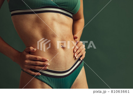 Beautiful body of young caucasian woman in green lingerie isolated on dark studio background. Natural beauty concept. 81063661