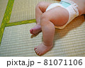 赤ちゃんのムチムチなあし 81071106