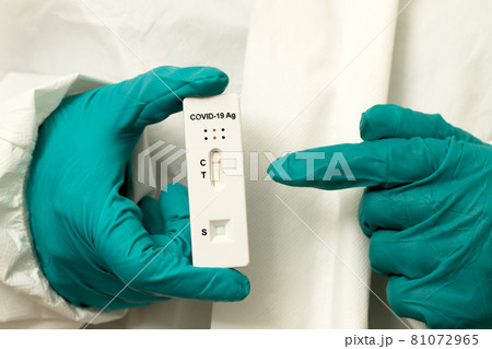 Doctor with Covid-19 test kit from the lab at the hospital 81072965