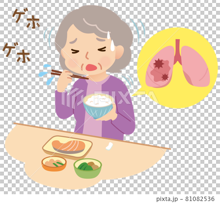 Aspiration: Elderly people who swallow during meals 81082536