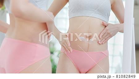 asian woman after giving birth asian woman after giving birth 81082849