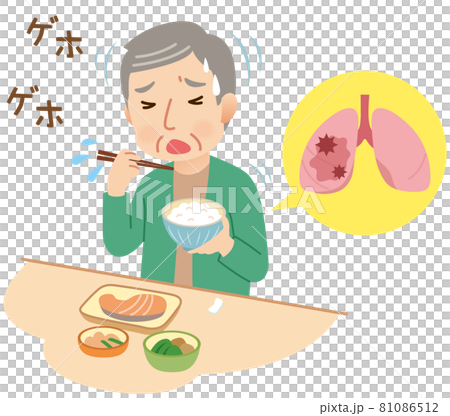 誤嚥　食事中にむせる高齢者 81086512