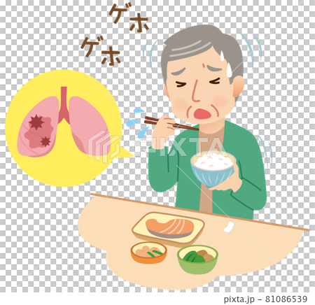 Aspiration: Elderly people who swallow during meals 81086539