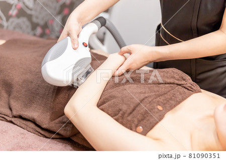 脱毛の施術スタッフと女性(腕) 脱毛の施術スタッフと女性(腕) 81090351