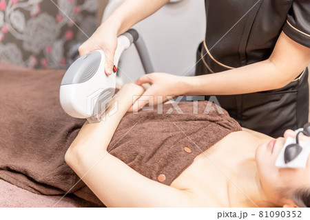 脱毛の施術スタッフと女性（腕） 81090352