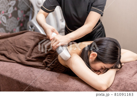 脱毛の施術スタッフと女性（背中） 81091163