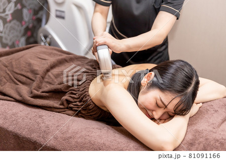 脱毛の施術スタッフと女性（背中） 81091166