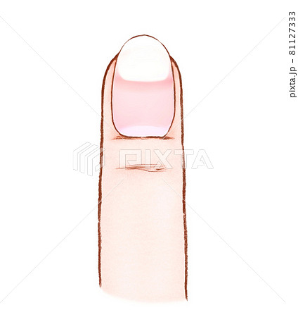 爪甲剥離症 白く浮いた爪のイラストのイラスト素材